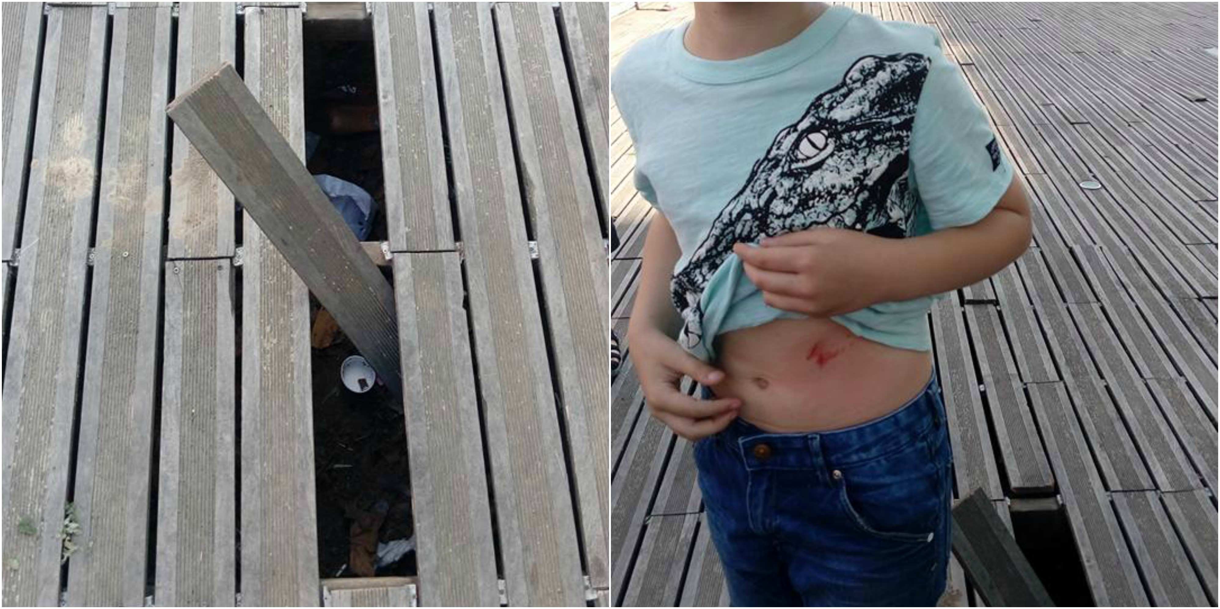 FOTO. Copil rănit în ”Groapa lui Gyusi”. O scândură l-a lovit în abdomen