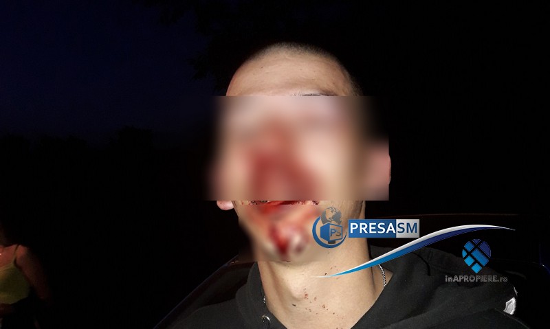 FOTO. Tânăr bătut crunt la un picnic. Poliția Locală, acuzată că nu a intervenit la timp