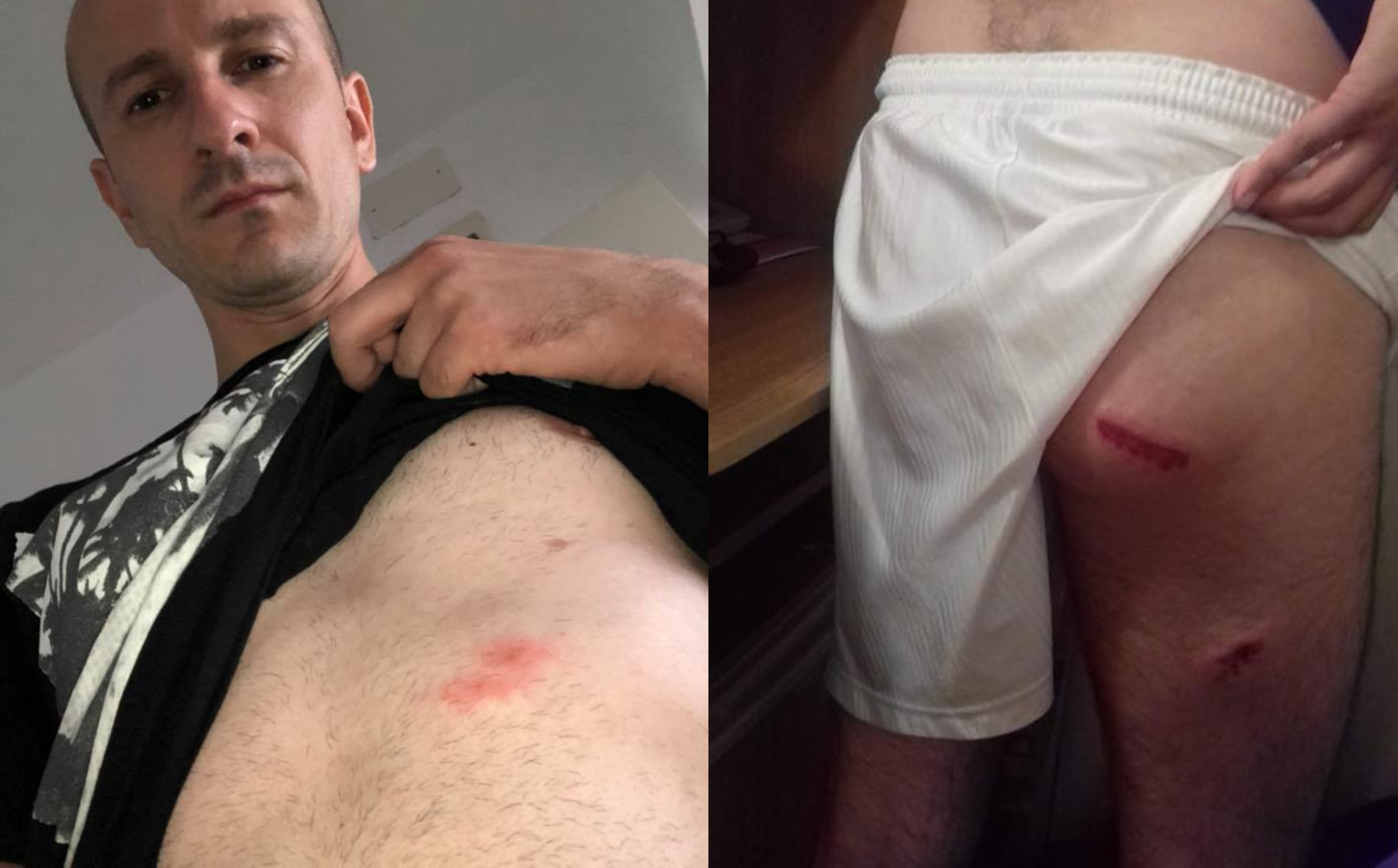 INTERVIU. Mărturii terifiante de la protestele din București. Sătmăreni bătuți!