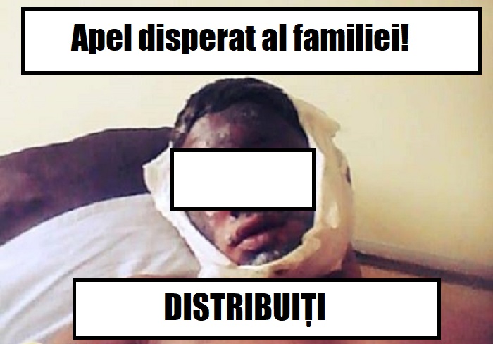 Minor rănit într-o explozie, în orașul Ardud