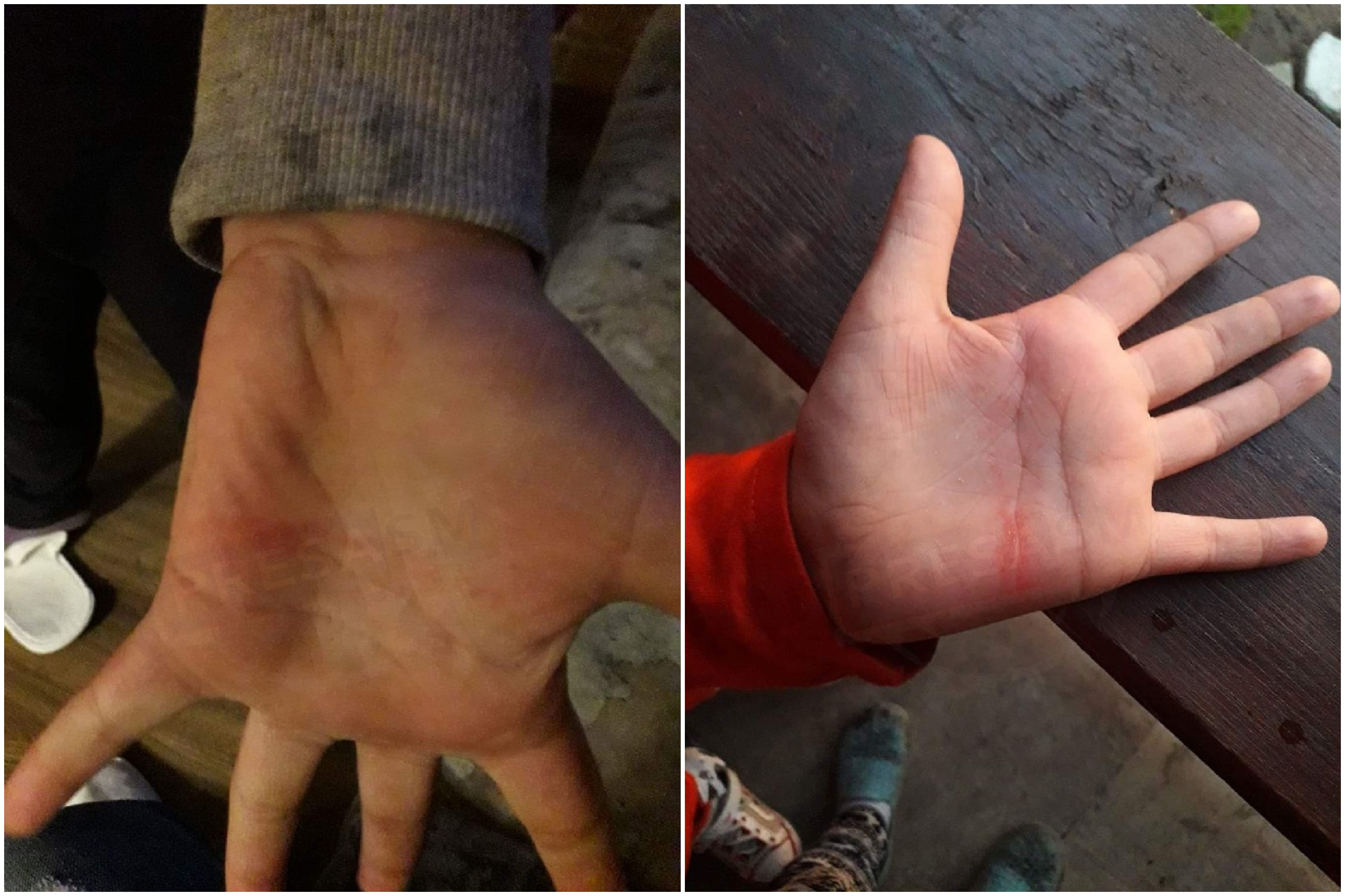 FOTO. Copilași bătuți la o școală din județul Satu Mare?! Părinții cer anchetă, acuzând o mușamalizare