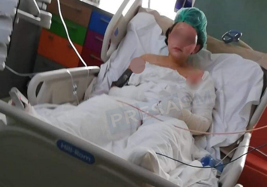 FOTO. Haideți să o salvăm pe Berni! Victima exploziei are nevoie urgentă de sânge