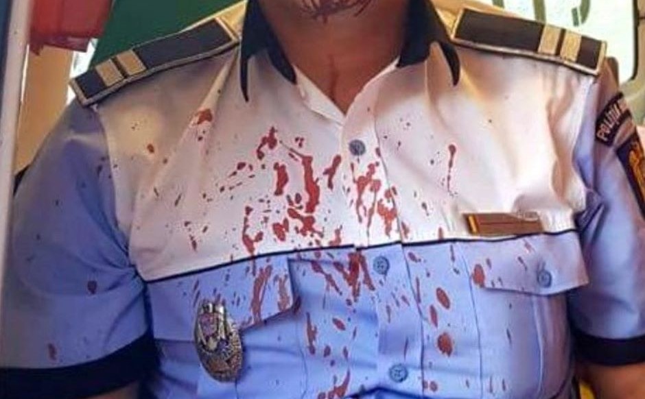 FOTO/VIDEO. Doi polițiști au ajuns la spital. Au fost bătuți în timpul misiunii