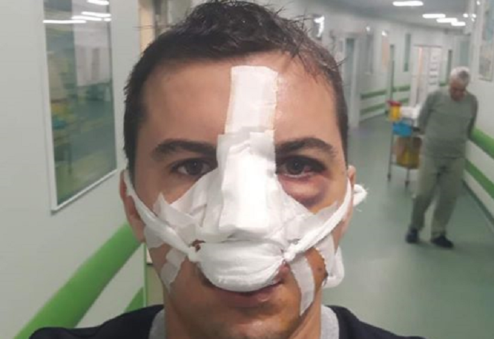 FOTO/VIDEO. Polițist, la un pas să fie omorât. Are acasă doi copii și o soție