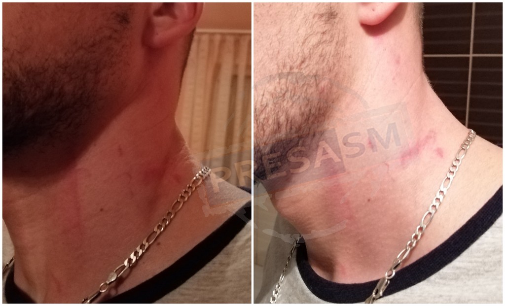 FOTO. Ceartă de pomină între doi iubiți, tranșată de Poliție cu strânsul de gât!