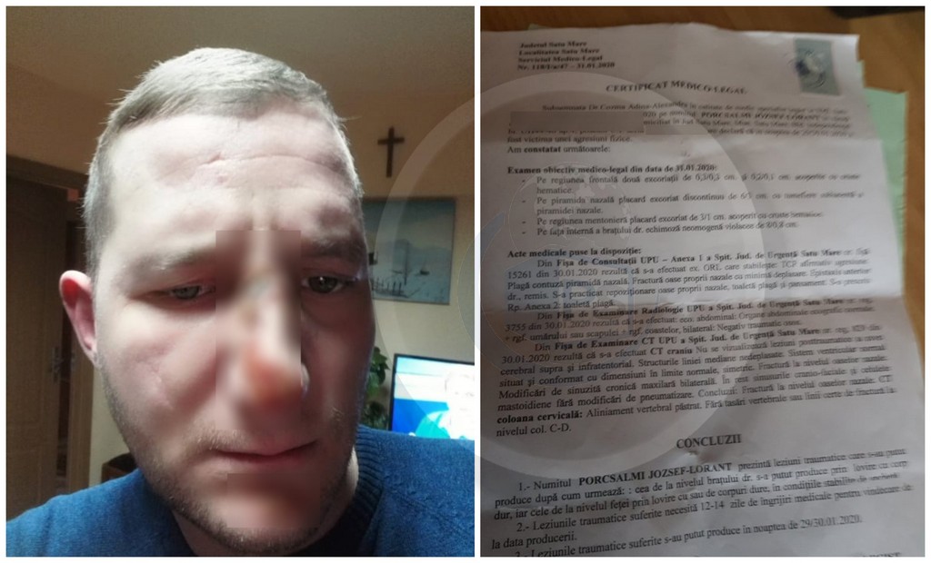 FOTO. Un sătmărean susține că a fost călcat în picioare de polițiști. Poliția spune altceva