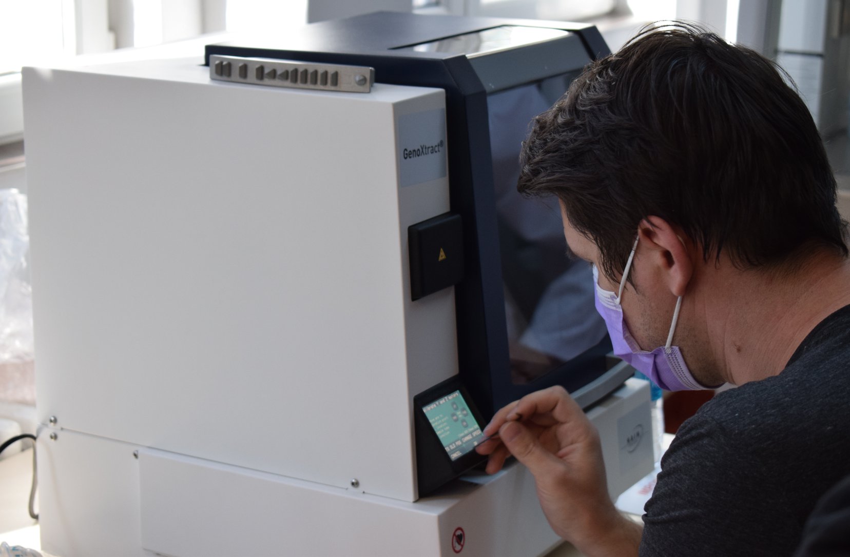 Care sunt cauzele creșterii nivelului de acid uric în sânge și cum poate fi prevenit?