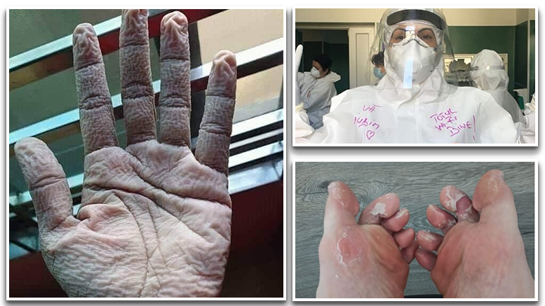 FOTOGALERIE. Imagini zguduitoare cu cadrele medicale din spitalele COVID din țară