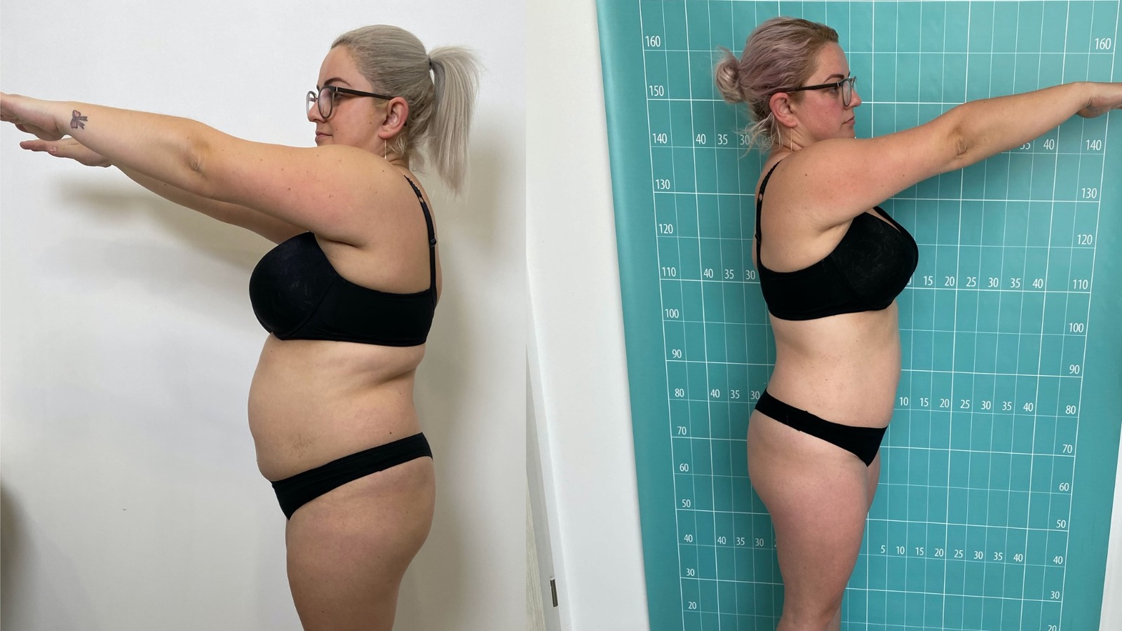 Slăbește spectaculos vara aceasta cu ajutorul specialiștilor Pearl Beauty Center