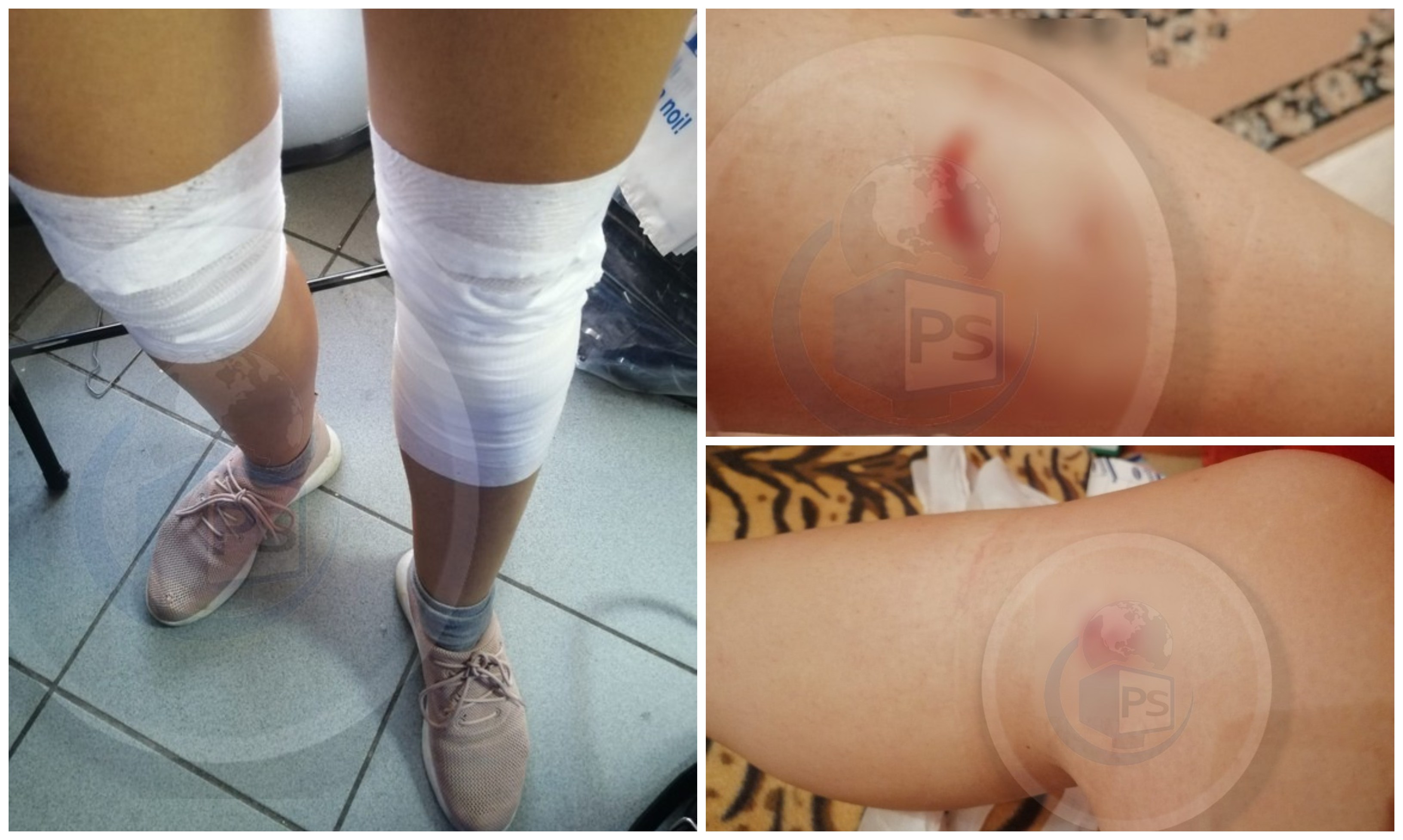 FOTO. ATENȚIE! Haită de câini atacă oameni într-o localitate din județul Satu Mare