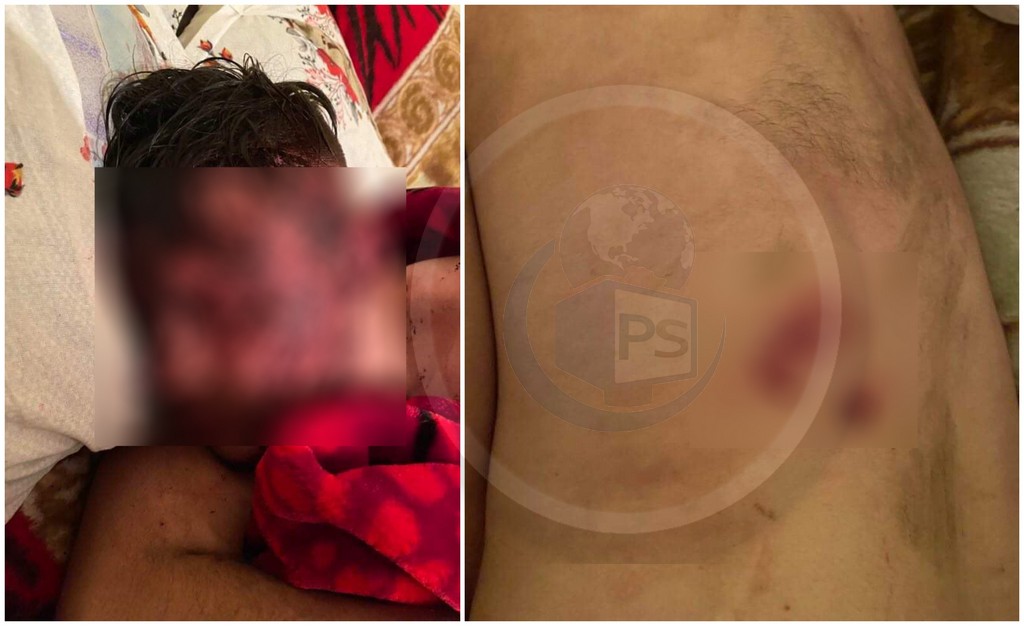 FOTO. Chef cu zeci de persoane, terminat crunt pentru un tânăr, în județul Satu Mare