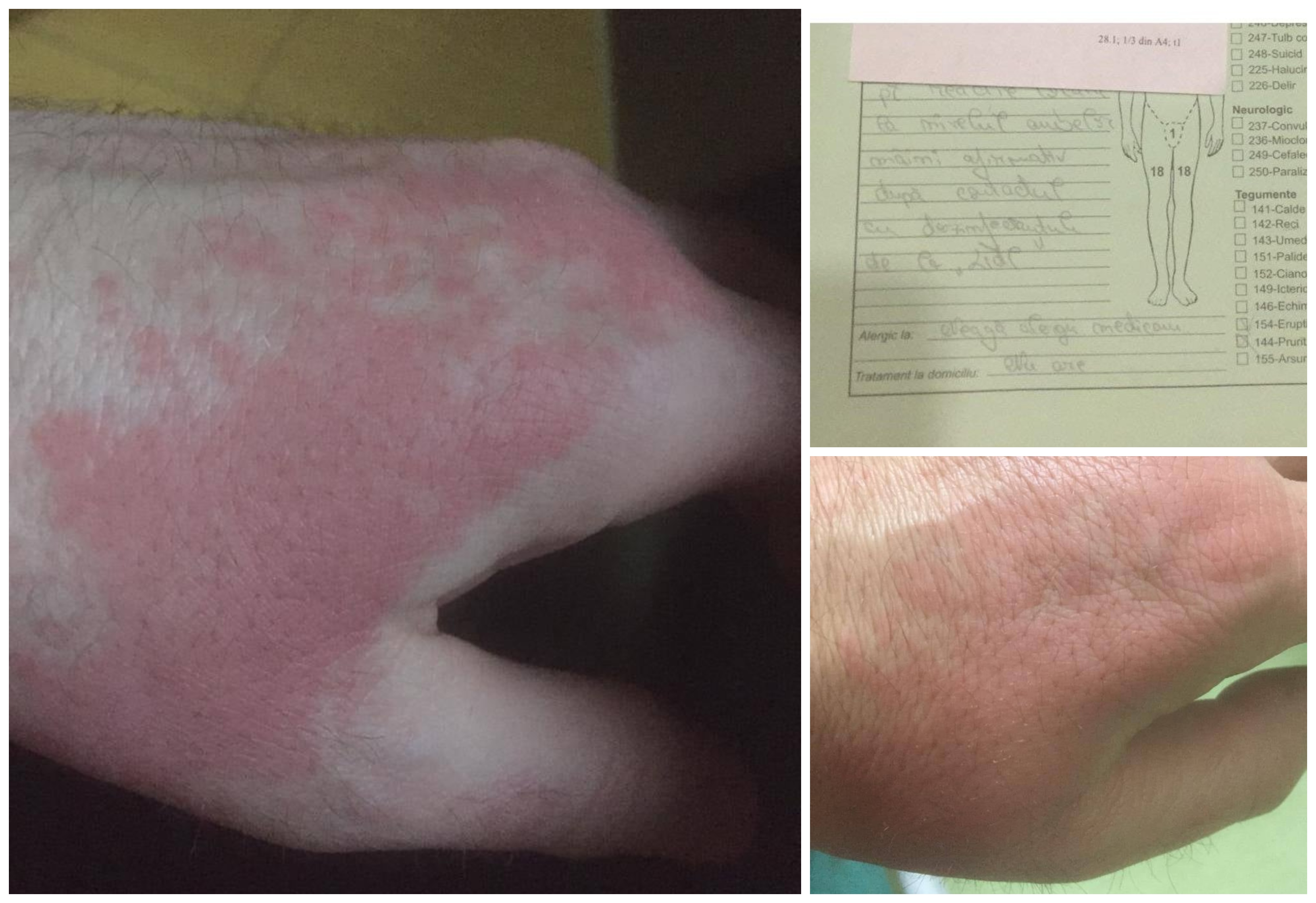 Județul Satu Mare: de la supermarket direct la spital. După ce s-a dezinfectat pe mâini