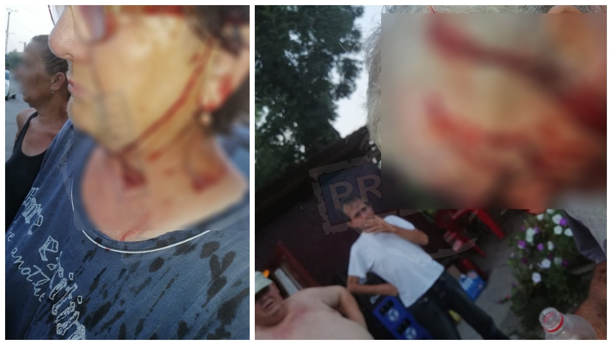 FOTO. Sătmăreni, soț și soție, bătuți crunt la o terasă din județ. Agresorul, în libertate