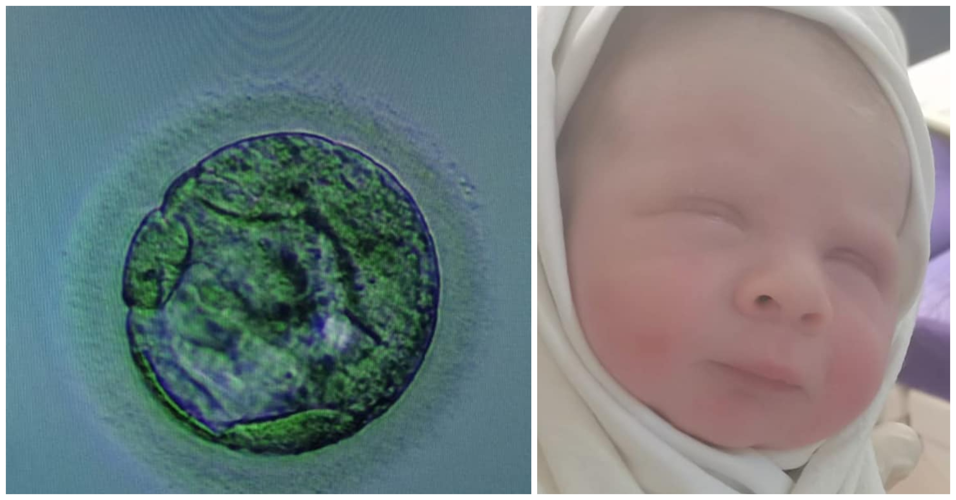 FOTO. Premieră medicală în Satu Mare! S-a născut primul bebeluș fertilizat in vitro