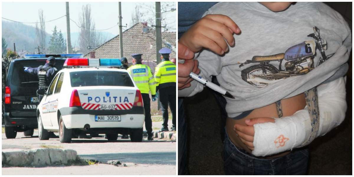 SATU MARE. O mamă i-a rupt mâna copilului (7 ani). Bătut pentru că a zgâriat televizorul