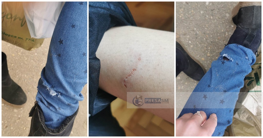 FOTO. Revoltător! Încă o tânără mușcată de maidanezi în centrul municipiului Satu Mare