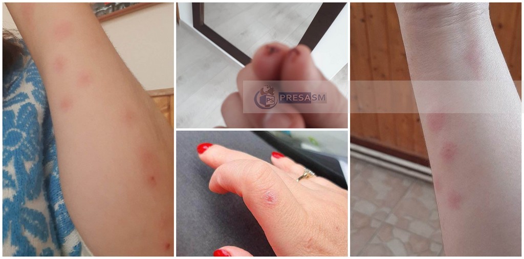 FOTO. Coșmarul trăit de soția unui polițist din Satu Mare. Ce i-a dus acasă soțul