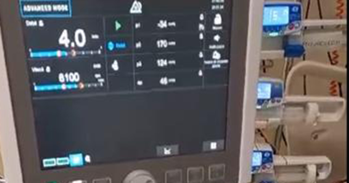 FOTO. O șansă în plus pentru pacienții cu afecțiuni pulmonare grave, la Spitalul Județean Satu Mare