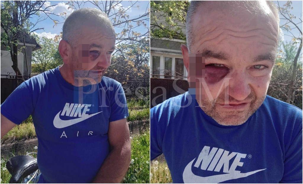 FOTO. O gașcă de minori a intrat peste un vârstnic și l-au bătut în casă, în Supur