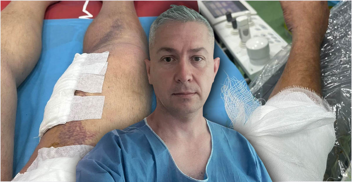 Intervenție de succes la Satu Mare: Picior salvat de la amputare printr-o procedură minim invazivă