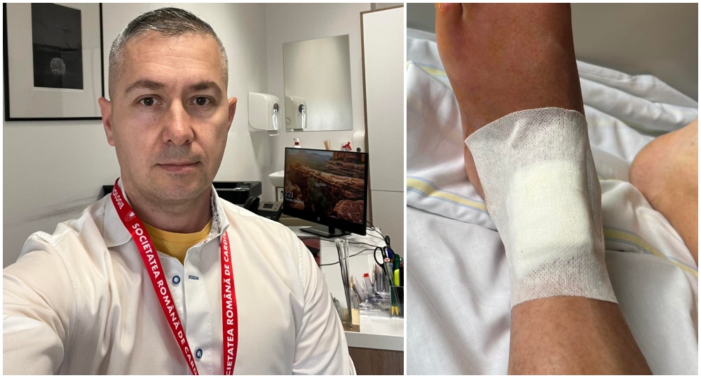 O nouă minune a Dr. Duțu, la Spitalul Județean: picior salvat de la amputație printr-o intervenție de excepție