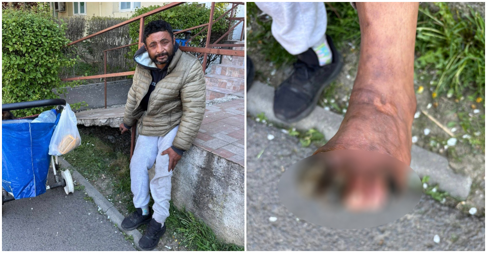 FOTO/VIDEO. Când ești prea sărac, cu afecțiune gravă și riști să mori în fața Spitalului Județean